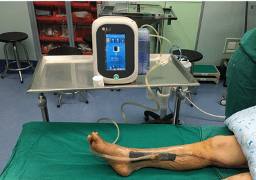 negative pressure wound therapy