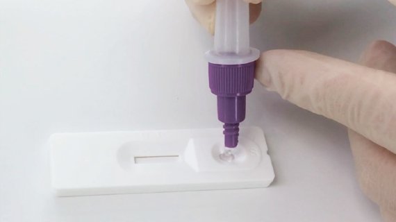 In-vitro diagnostic test for qualitative detection of SARS-CoV-2 antigen