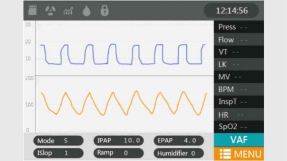 Data Monitoring Interface of Ventilator