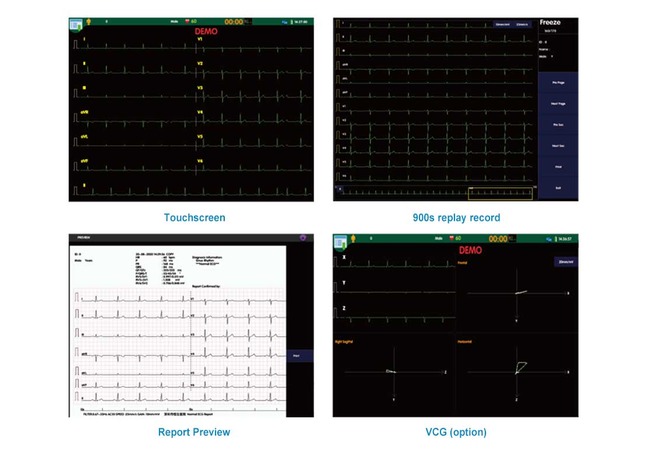 ECG device interface and report examples from the existing product page